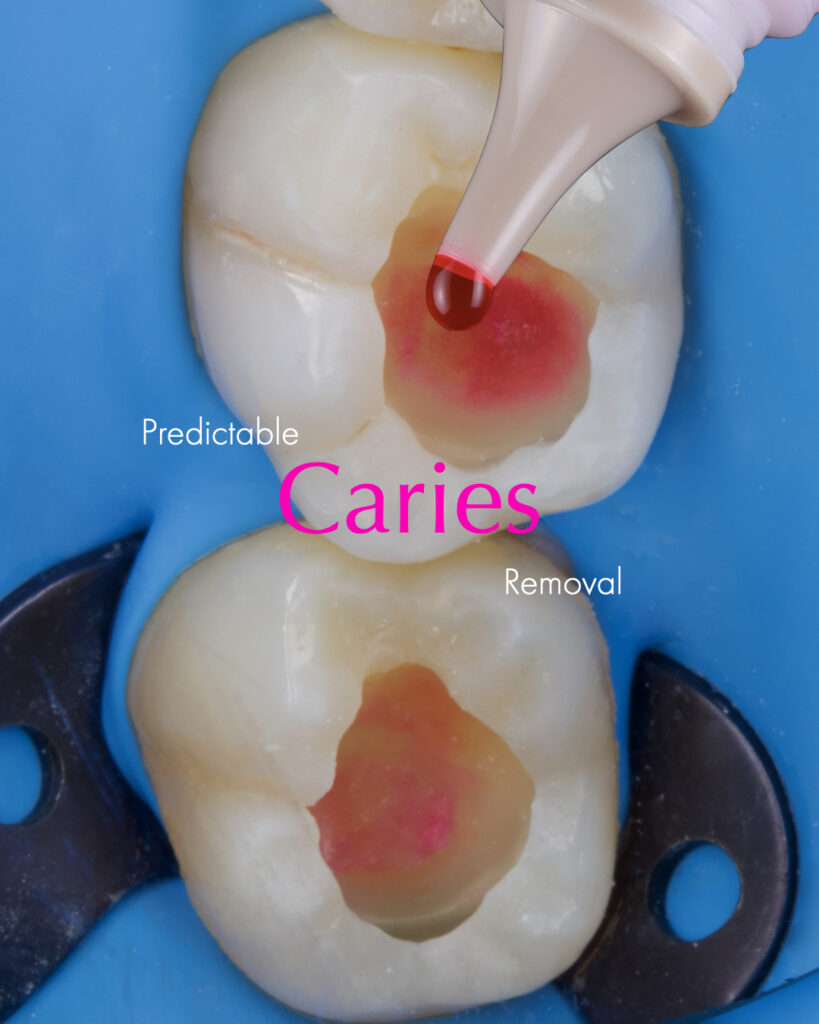 Introduction to Biomimetic Restorative Dentistry (BRD) Brochure Page 3