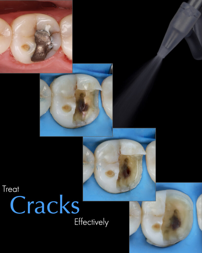 Introduction to Biomimetic Restorative Dentistry (BRD) Brochure Page 4