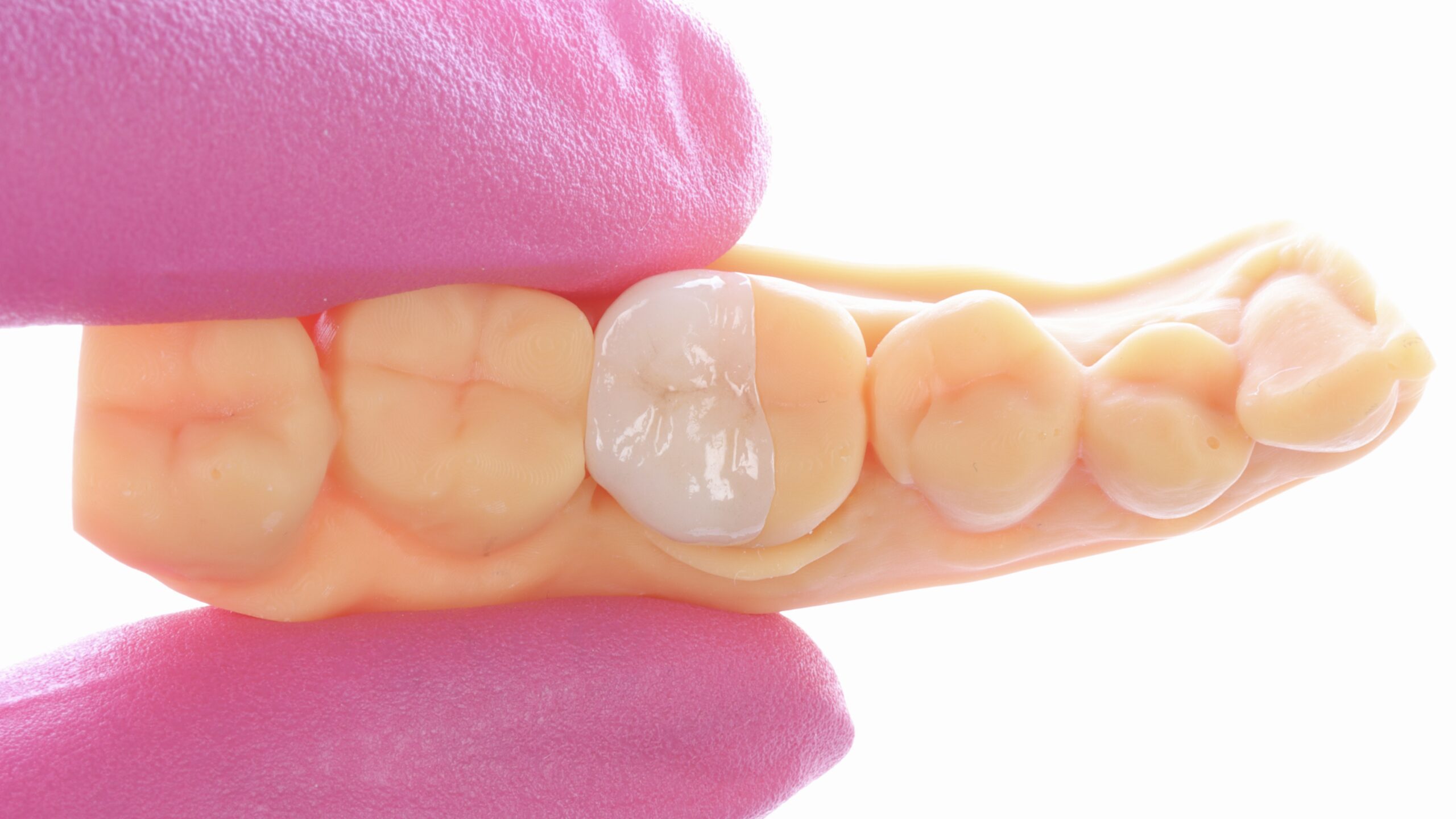 Orthodontics & Clear Aligners